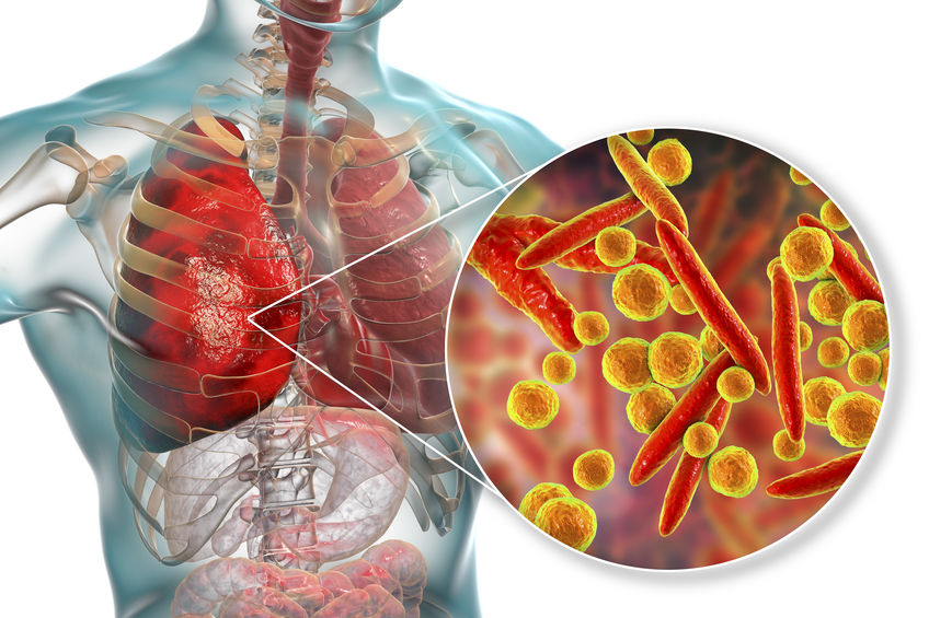 Mycoplasma